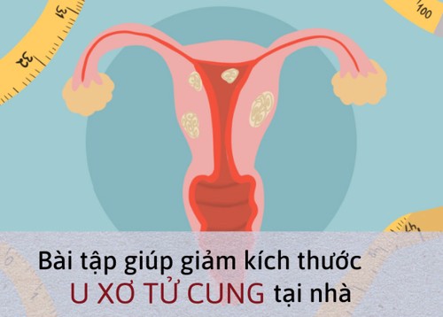 Bật mí 4 tác dụng chữa u xơ tử cung bằng nghệ - [Xem ngay]